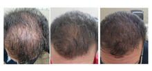 Load image into Gallery viewer, GOLDLUXE Hair & Scalp Treatment